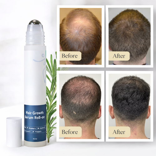 Hair Growth Serum Roll-On