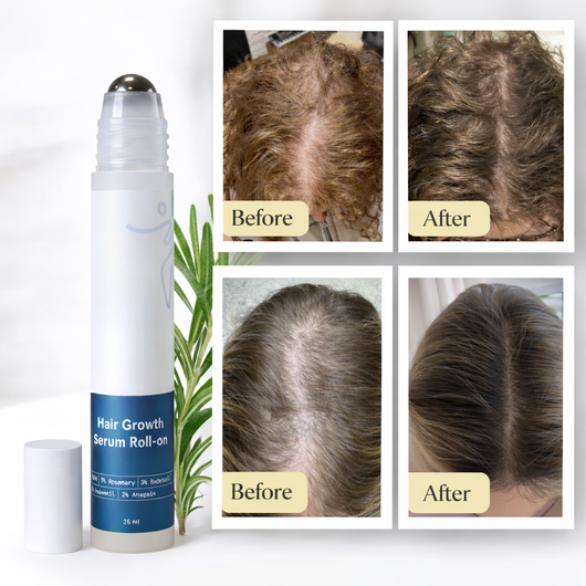 Hair Growth Serum Roll-On